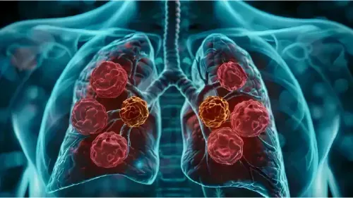 What is the Cost of a Lung Cancer Test?